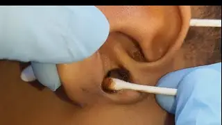 ASMR RELAXING EAR CLEANING WITH BUDS