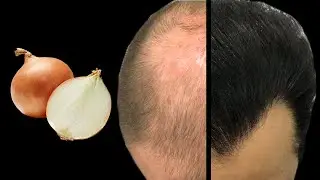 Hair grows like crazy and doesn't fall out! This is the most powerful tool! Strongest ingredient