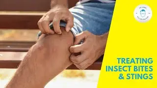 Summer Health Bummers - Treating Insect Bites and Stings | Insect Sting First Aid