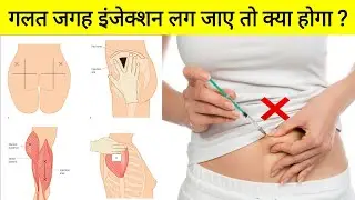 गलत जगह इंजेक्शन लग जाए तो क्या होगा ? गलत इंजेक्शन लग जाए तो क्या होगा ? injection site