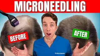 Does Microneedling Actually Regrow Hair? | Hair Surgeon's Advice