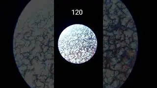 Blood under the microscope - magnification from 56 to 1350