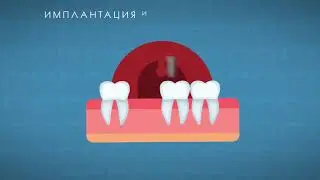Шейповая 2D-анимация для стоматологии