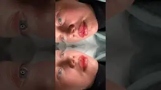 Ретушь видео для косметолога 💋 форма и объем губ не тронуты #beforeafter #ретушь #retouch