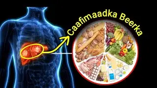 6-sheey oo muhiim u ah caafimaadka Beerkaada