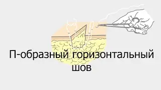 П — образный горизонтальный шов