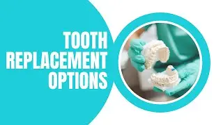 Before you replace missing teeth watch this! Tooth replacement options explained.