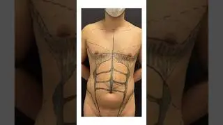 Veja até o final. LadSTRONG Spartan Way! A lipohd para homens. Você faria?
