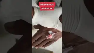 Intravenous cannulation | iv cannulation | cannulation procedure| #shorts