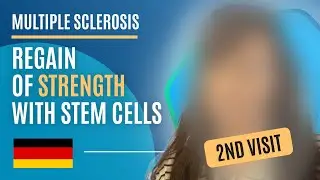 2nd Stem Cell Treatment for Multiple Sclerosis: Story of a Patient from Germany