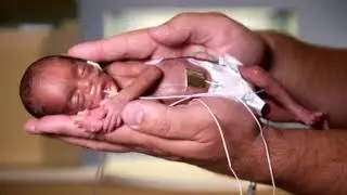 ДЕТИ ВЫЖИВШИЕ ПОСЛЕ АБОРТОВ_Full-HD