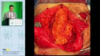 Mesh Sutured repairs AWR 2016