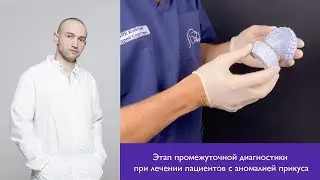 Койстрик Андрей Сергеевич/Этап промежуточной диагностики при лечении пациентов с аномалией прикуса.