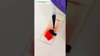 Platelet count of Blood 