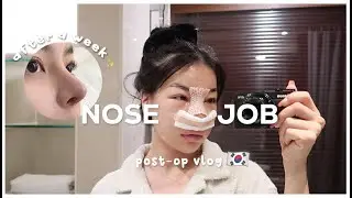 MY NOSE JOB POST-OP VLOG 🇰🇷 a week in my life | Erna Limdaugh