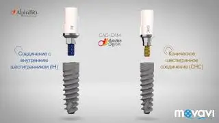 Установка импланта Alfa Bio