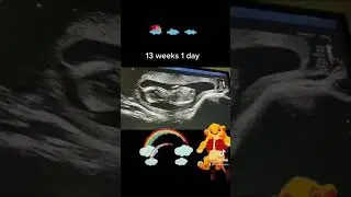 July 20, 2022 Double Rainbow Baby!