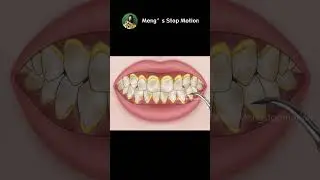 ASMR Animation | How to fix Bad Breath? 🦷Dental Cleaning to Remove Heavy Tartar!