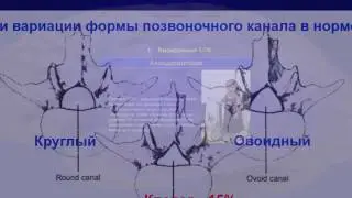Лекция 2 Этиопатогенез стенозов позвоночного канала