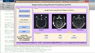 Matlab code for Image Fusion using Wavelet Transform & PCA