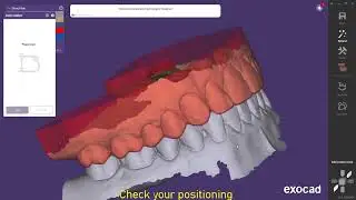 AXP Files - Import to exocad and controll the positioning