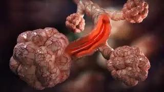 3D Animated Medical Video - Asthma Explained | What Is Asthma?