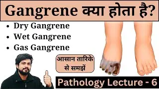 Gangrene || Types of Gangrene - Gas, Dry & Wet || Treatment || Pathology Lecture in Hindi