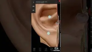 ENT 002 c Helix Anti Helix Anti Tragus Ear Pinna