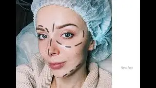 Новое лицо//Так ли дорого стоят услуги косметолога