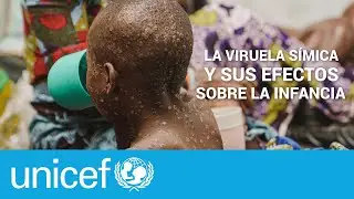 ¿Cómo proteger a los niños y niñas de la viruela símica o mpox? | UNICEF