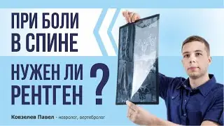 РЕНТГЕН не нужен при боли в спине? Разбираемся в вопросе с неврологом