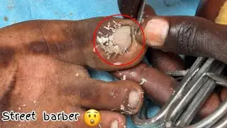 LOCAL STREET PEDICURE NAILS CUTTING TECHNIQUE BY A STREET BARBER.