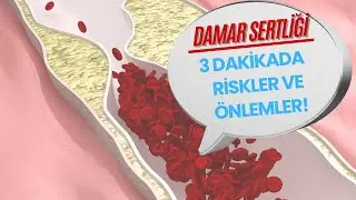 3 DAKİKADA ATEROSKLEROZ (DAMAR SERTLİĞİ) RİSKLERİ VE ALINMASI GEREKEN ÖNLEMLER!
