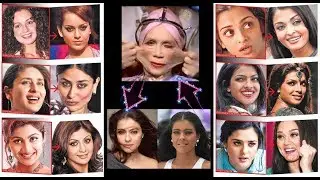 Top 15 Bollywood Actresses Before And After Plastic Surgery