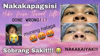 HIKO NOSE THREAD LIFT | GONE WRONG? | SOBRANG SAKIT | AVATAR LOOK