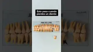 Esto pasa cuando pierdes un diente #odontologia #diente #dentalcare