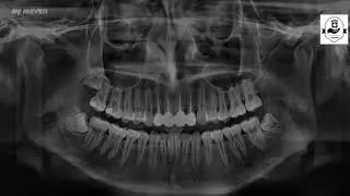 Meyer dental CBCT Intelligent Image Processing from ADAE Dental Store
