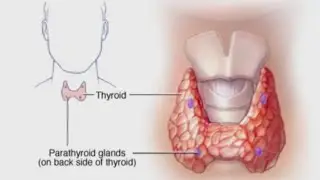 Healthcast: Dangers of high calcium