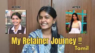 Life After Braces 😬 | Retainer Journey 2.0 | What No One Tells You in TAMIL 