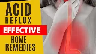 Finding Relief from Acid Reflux Effective Home Remedies