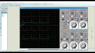 ECG Signal Acquisition Circuit - Proteus Simulation