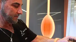 Are you thinking about having a hair transplant procedure?