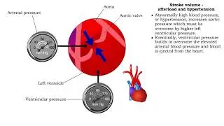 Stroke volume - afterload definition & hypertension