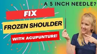 FIX Frozen Shoulder with Acupuncture