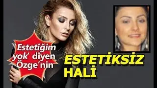 Özge Ulusoy'un estetiksiz hali şok etti