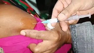 IM Intramuscular Arm injection Push. Triamcinolone  injection Video.  24 Ep 107 Anik Health Tips