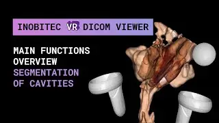 Inobitec VR DICOM Viewer functionality overview. Segmentation of cavities. Colon visualization.
