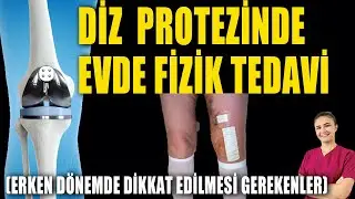 DİZ PROTEZİNDE FİZİK TEDAVİ 