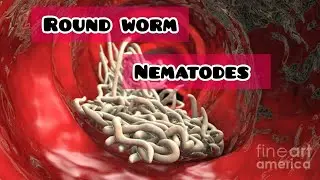 #Round Worms ❗