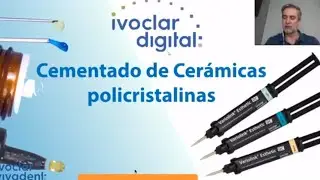 Cementado de Cerámicas Policristalinas